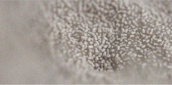 Brewer’s yeast Brewer’s yeast is one of the main sources of vitamin B9