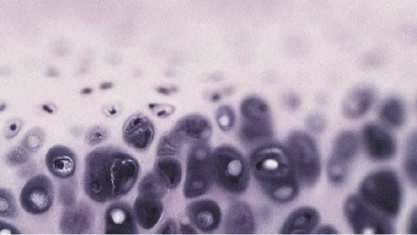 Microscopic view of cartilage tissue How collagen may help relieve knee osteoarthritis
