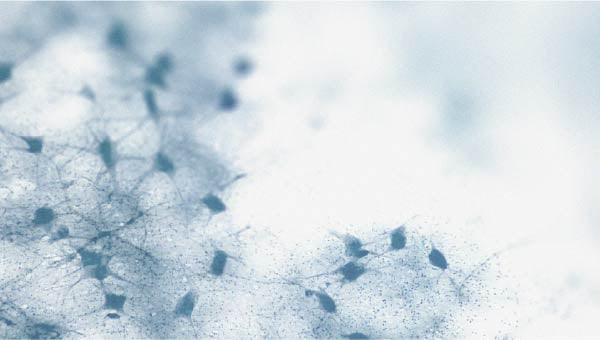 Neurons Could there be a link between cholesterol levels and cognitive decline?