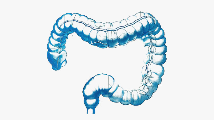 Colitis and bowel treatments