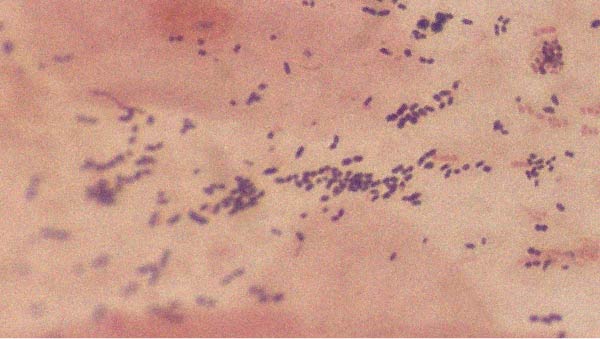 Lactobacillus acidophilus Everything you need to know about Lactobacillus acidophilus