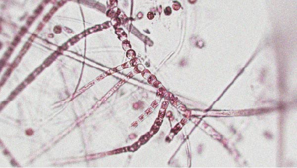 Microscopic view of microorganisms A healthy and diverse microbiota may support longevity