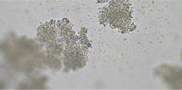 Microscopic view of bacteria Probiotic strains that may help relieve diarrhoea